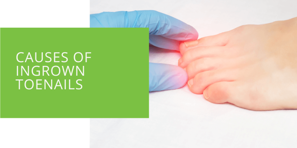 Causes of Ingrown Toenails