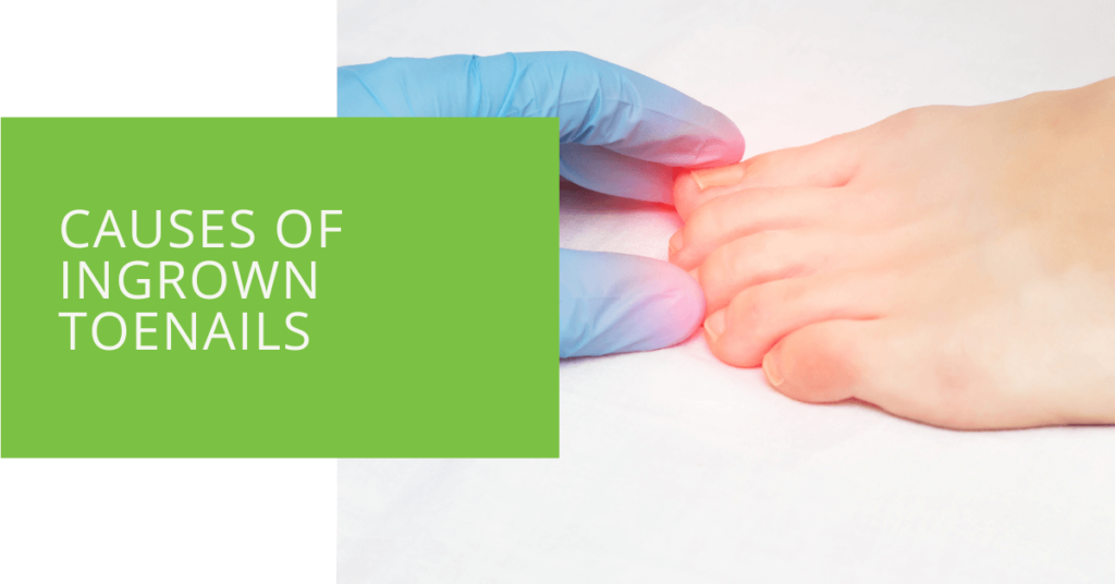 Causes of Ingrown Toenails