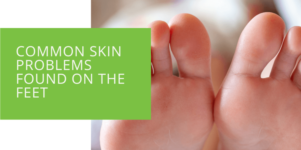 Common Skin Problems Found on the Feet