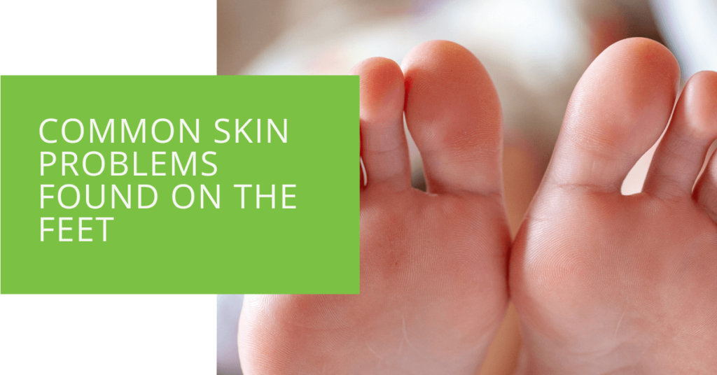 Common Skin Problems Found on the Feet