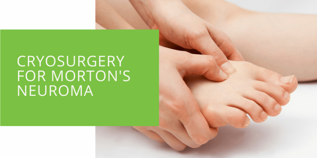 Cryosurgery for Morton's Neuroma