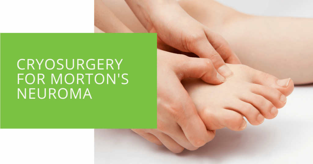 Cryosurgery for Morton's Neuroma