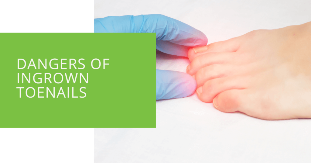 Dangers of Ingrown Toenails