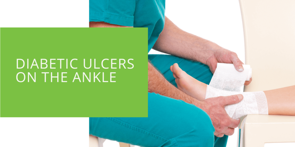 Diabetic Ulcers on the Ankle
