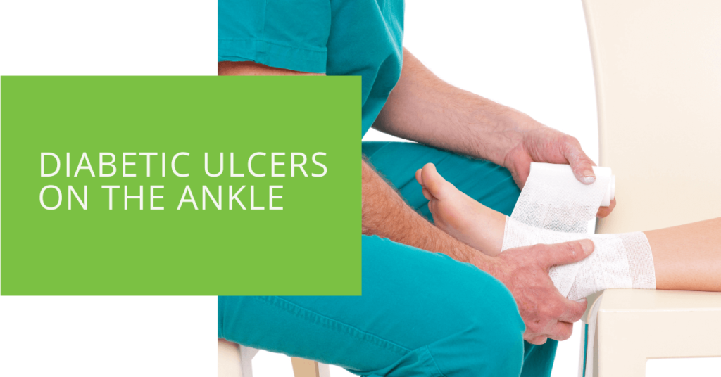 Diabetic Ulcers on the Ankle