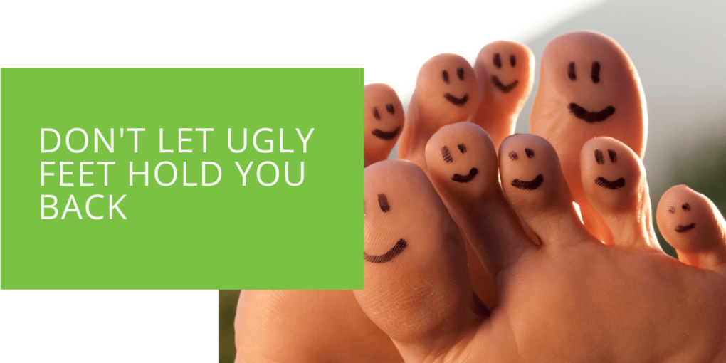 Don't Let Ugly Feet Hold You Back