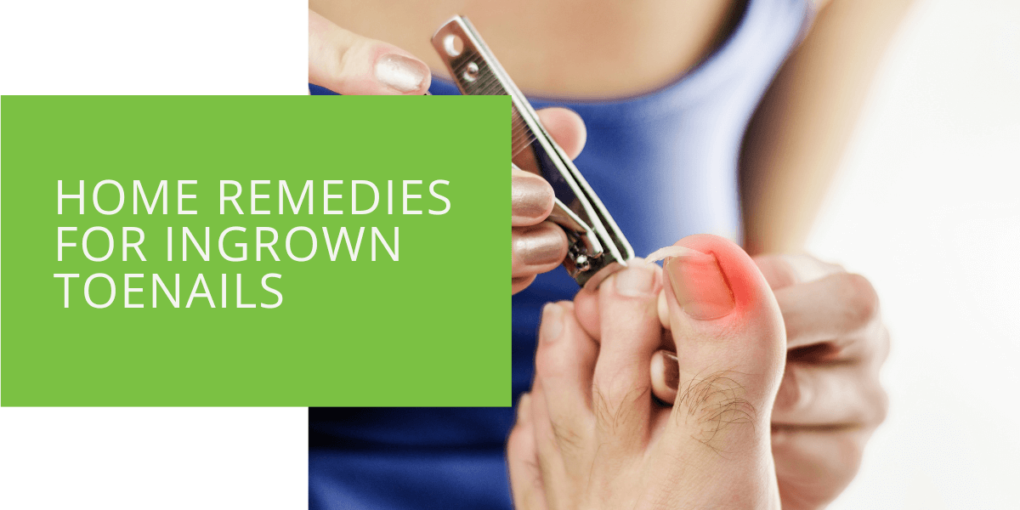 Home Remedies for Ingrown Toenails