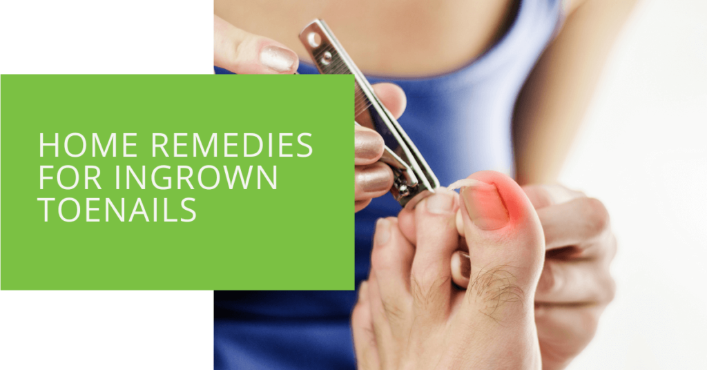Home Remedies for Ingrown Toenails