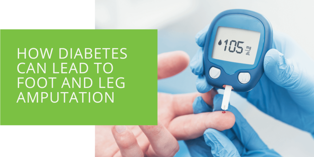 How Diabetes Can Lead to Foot and Leg Amputation