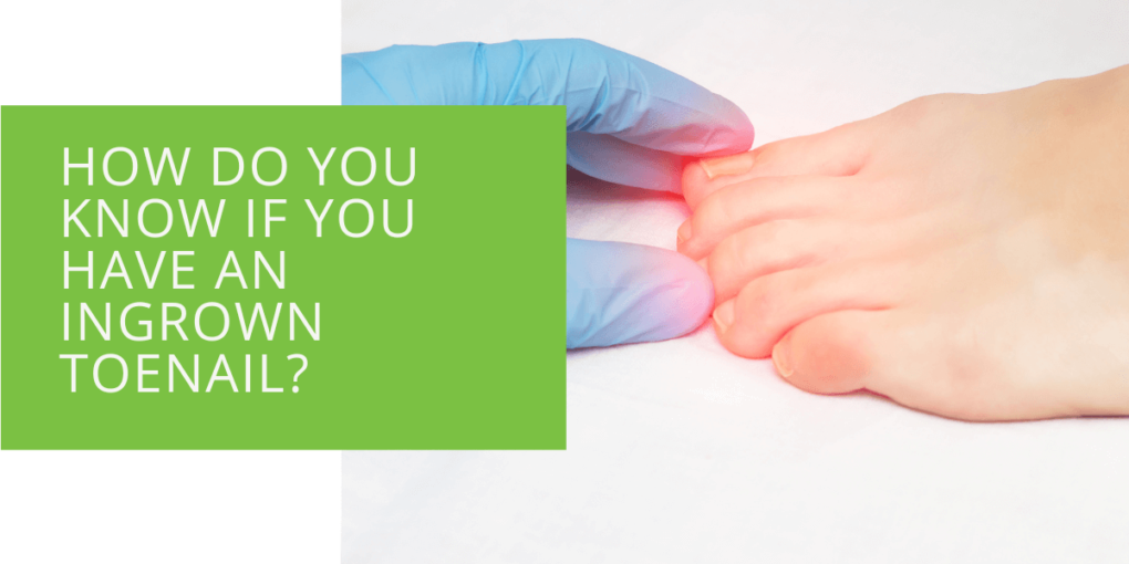 How Do You Know If You Have an Ingrown Toenail