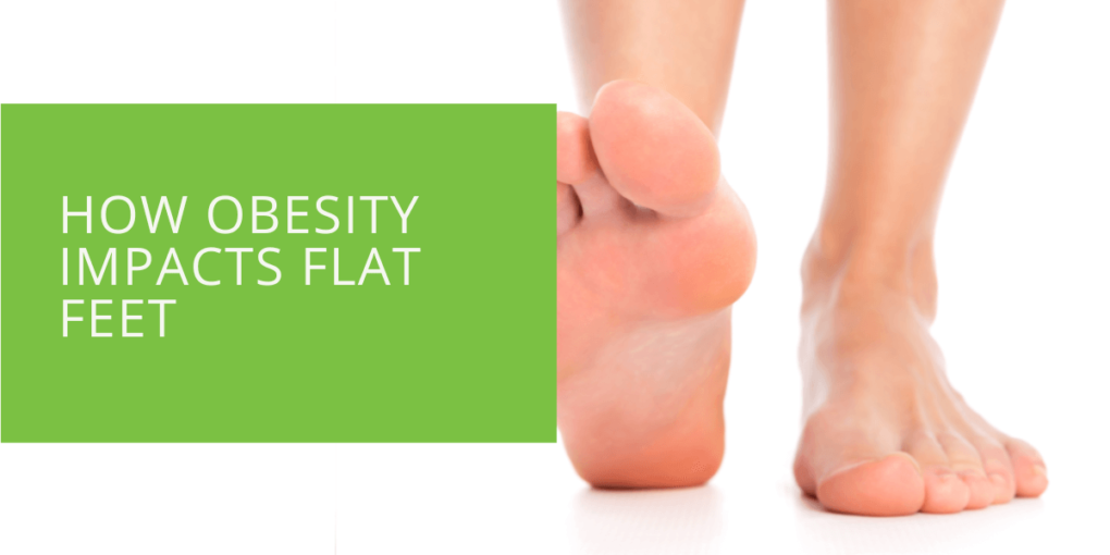 How Obesity Impacts Flat Feet