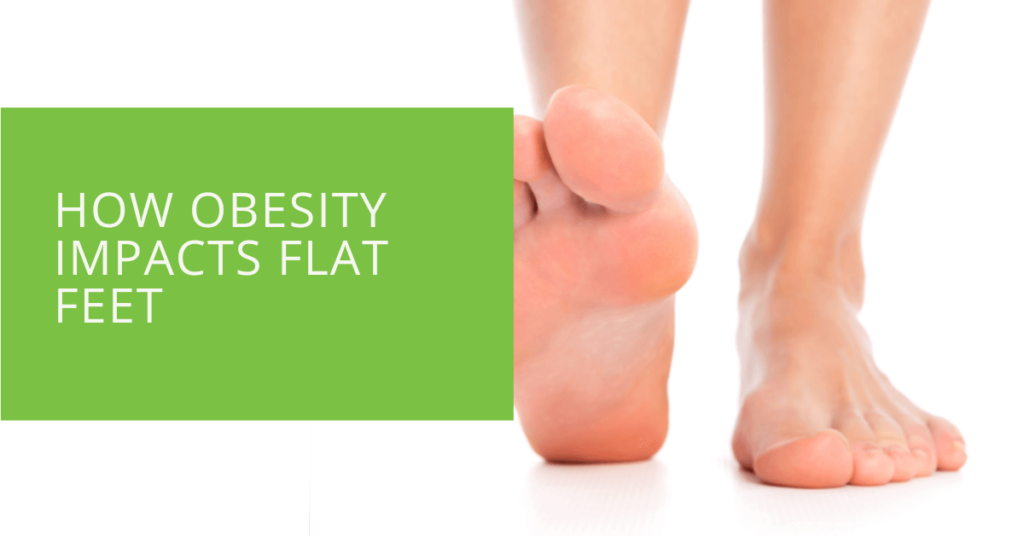 How Obesity Impacts Flat Feet