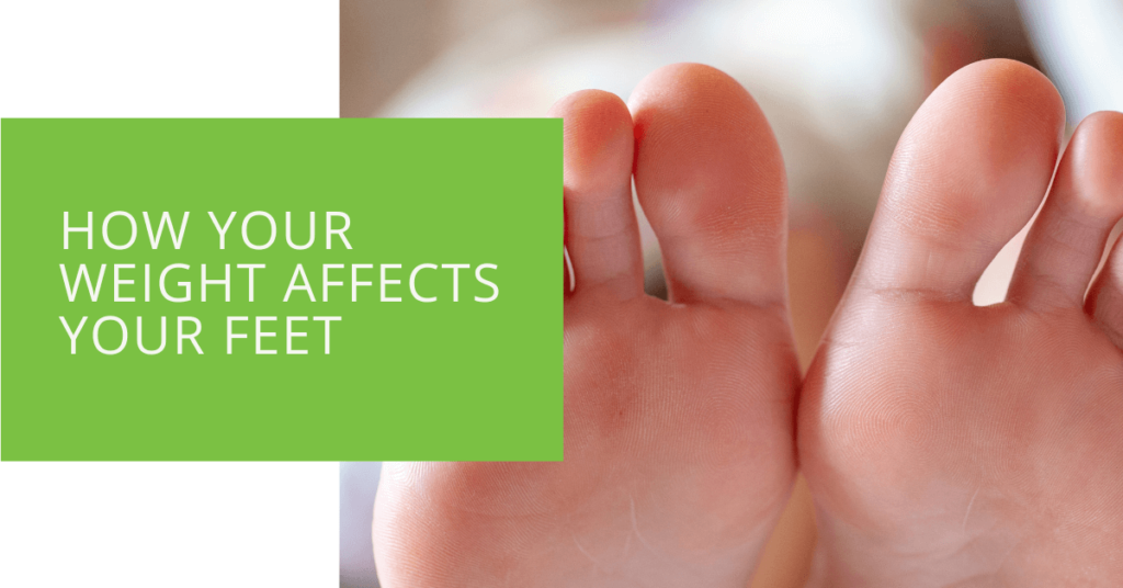 How Your Weight Affects Your Feet