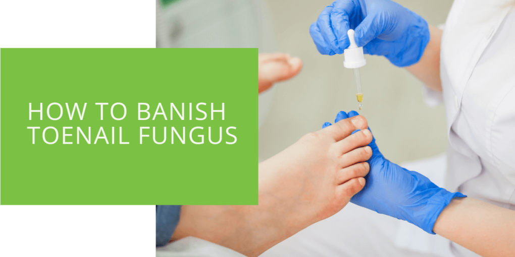 How to Banish Toenail Fungus