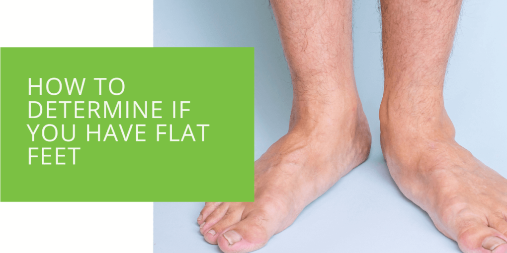 How to Determine If You Have Flat Feet