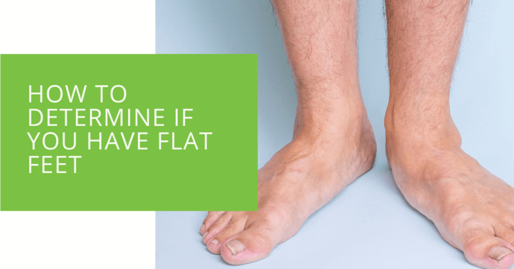 How to Determine If You Have Flat Feet