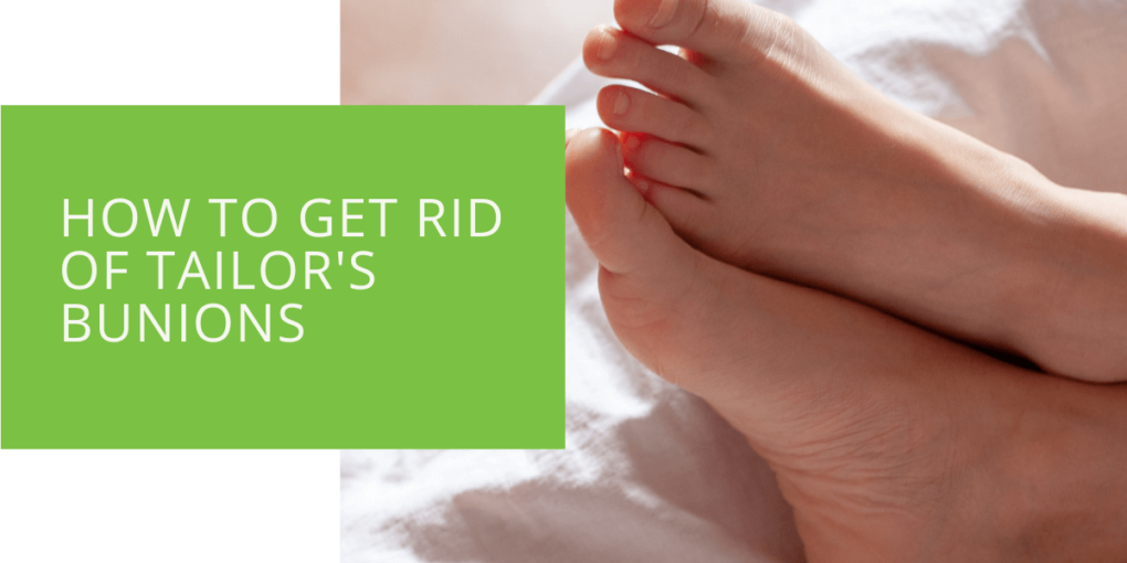 How to Get Rid of Tailor's Bunions