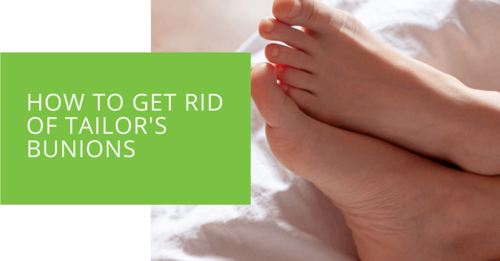 How to Get Rid of Tailor's Bunions