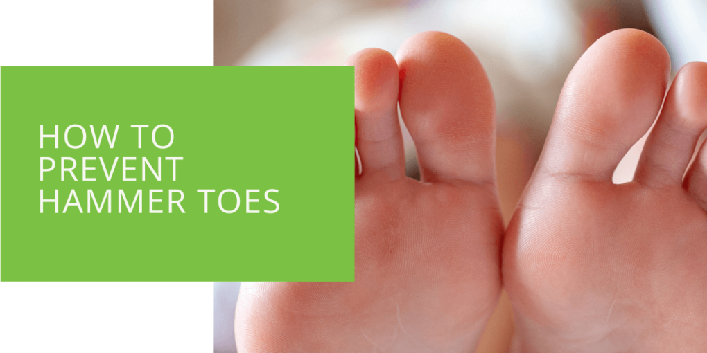 How to Prevent Hammer Toes