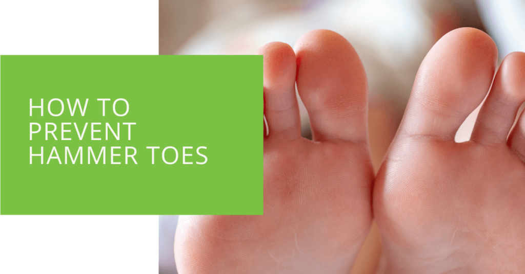 How to Prevent Hammer Toes