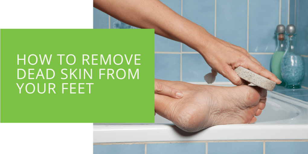 How to Remove Dead Skin from Your Feet