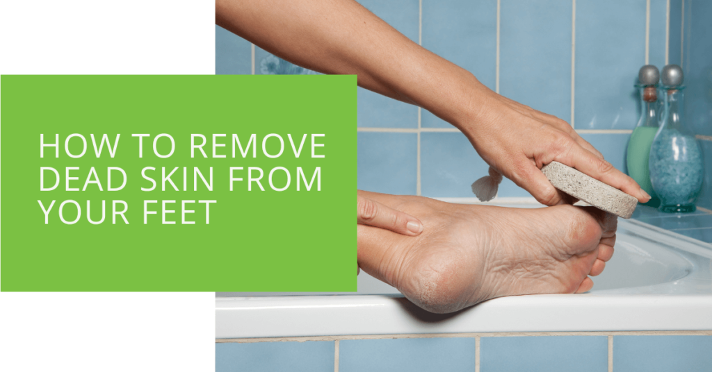 How to Remove Dead Skin from Your Feet