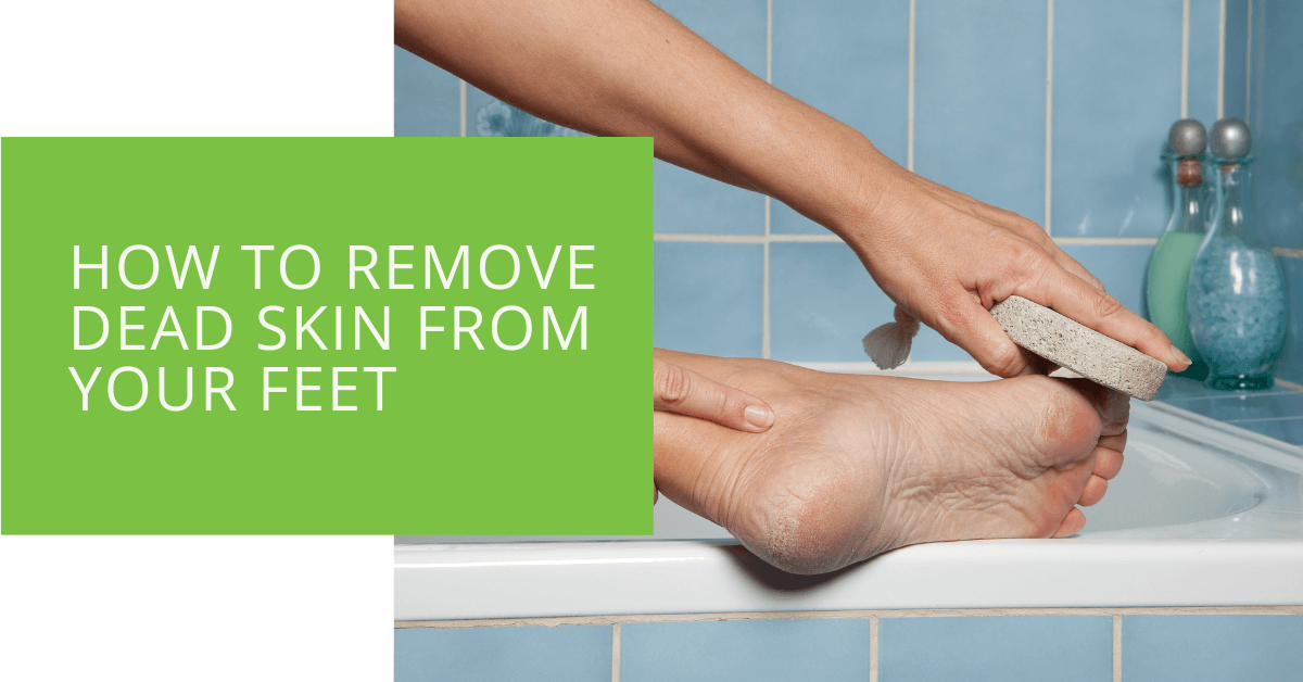 How To Remove Dead Skin From Your Feet Naturally? – Vedix