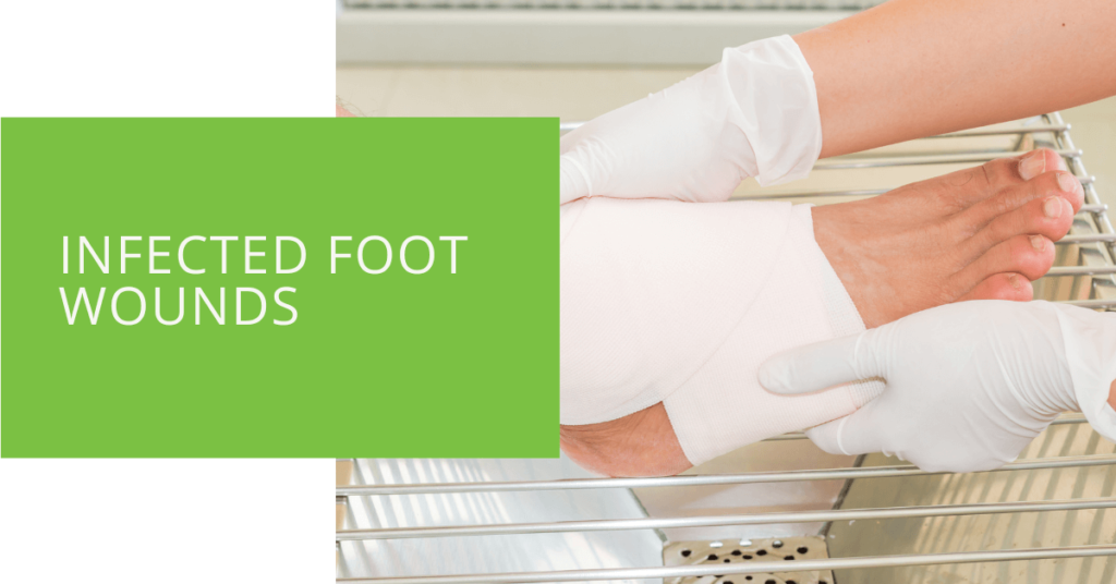 Infected Foot Wounds