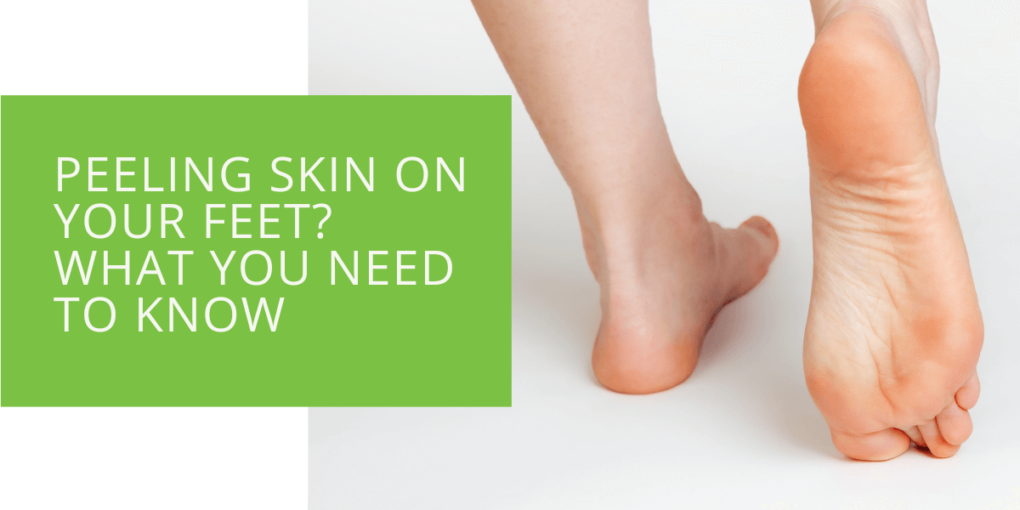 Peeling Skin on Your Feet What You Need to Know