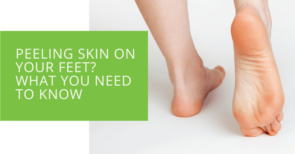 Peeling Skin on Your Feet What You Need to Know