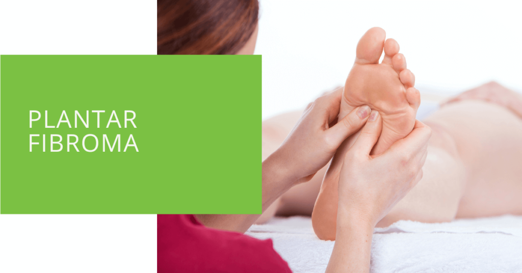 Plantar Fibroma