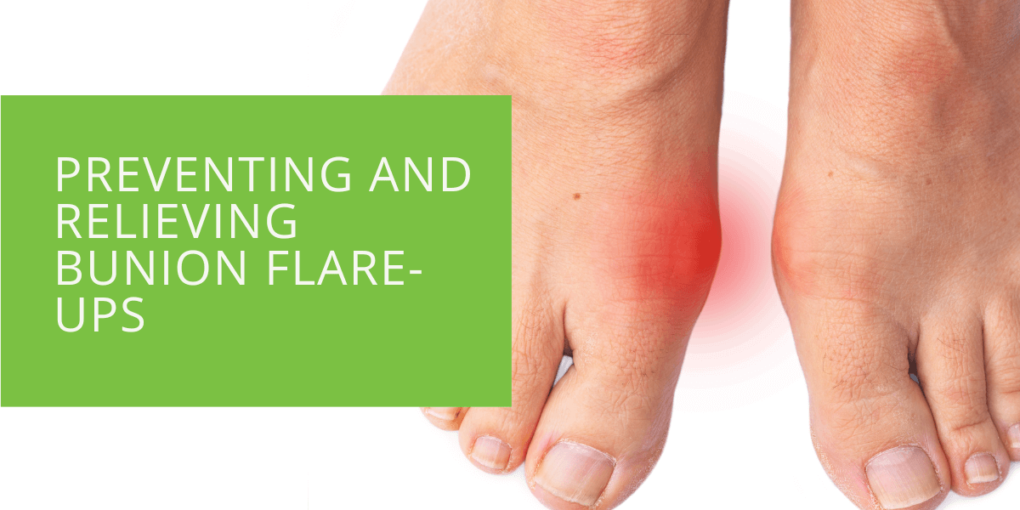 Preventing and Relieving Bunion Flare-Ups