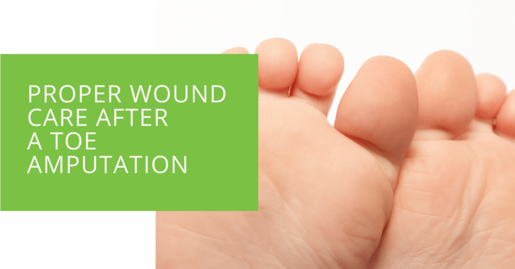 Proper Wound Care After a Toe Amputation