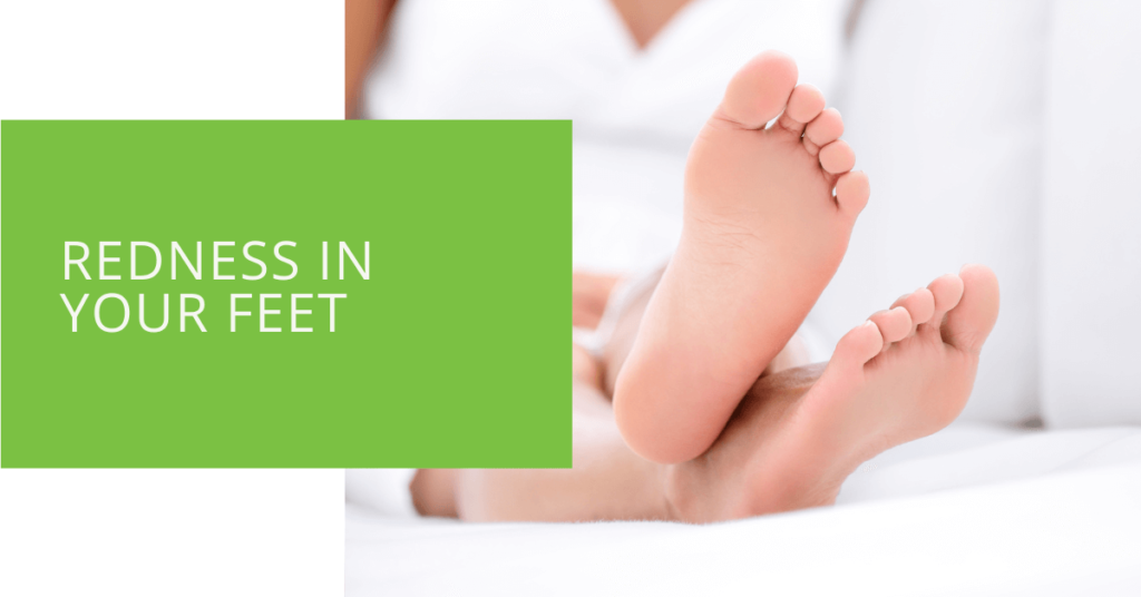 Redness in Your Feet