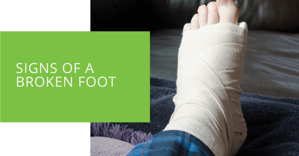 Signs of a Broken Foot