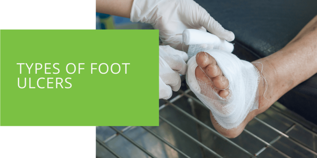 Types of Foot Ulcers