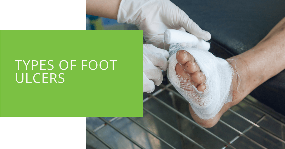 Types Of Ulcers On Foot Factory Sale