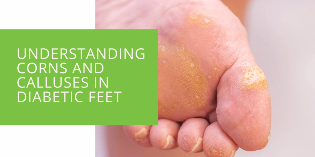 Understanding Corns and Calluses in Diabetic Feet