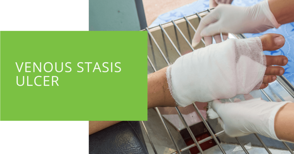 Venous Stasis Ulcer