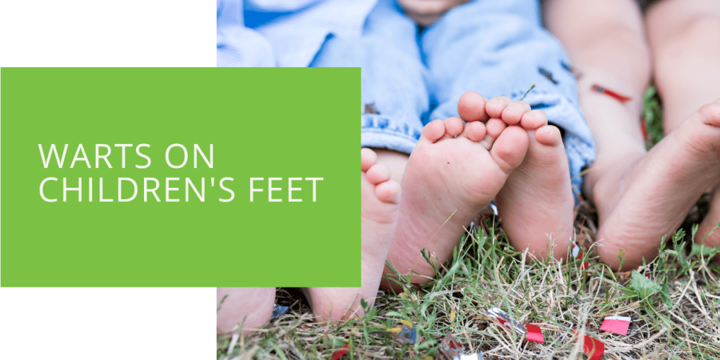Warts on Children's Feet