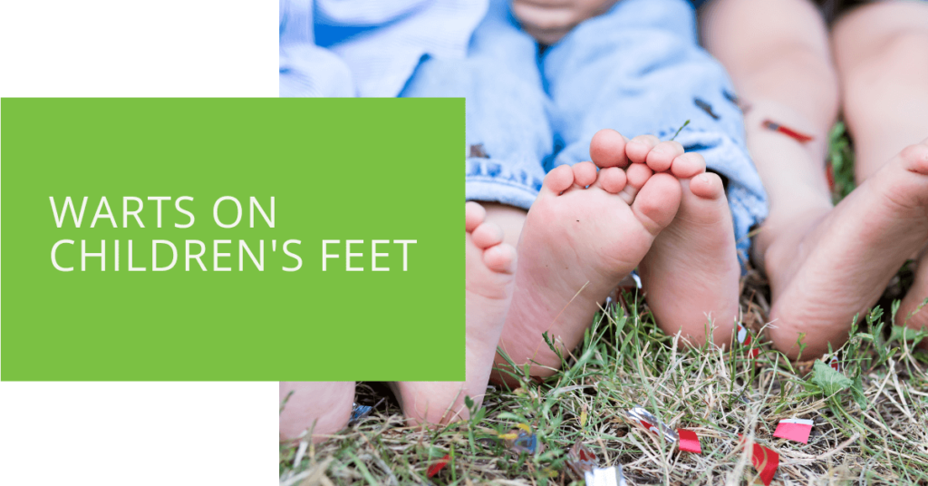 Warts on Children's Feet