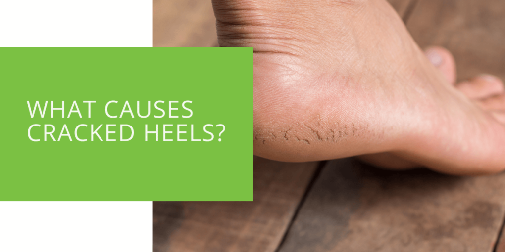 What Causes Cracked Heels