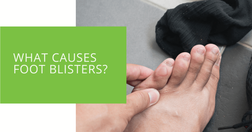 What Causes Foot Blisters