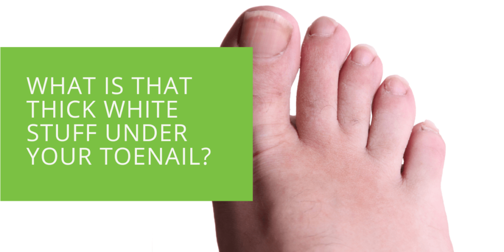 What is that Thick White Stuff Under Your Toenail