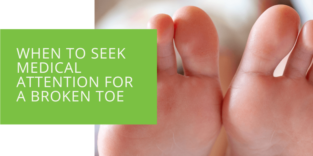 When to Seek Medical Attention for a Broken Toe