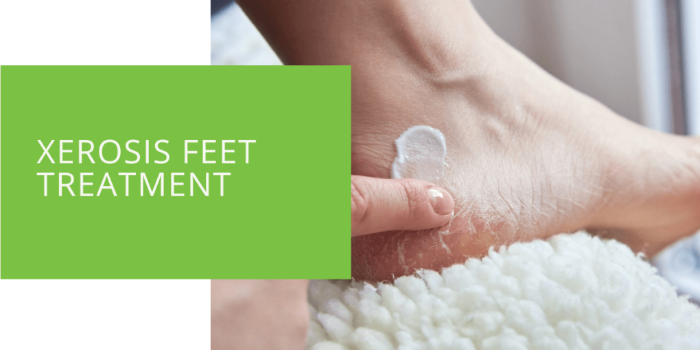 Xerosis Feet Treatment