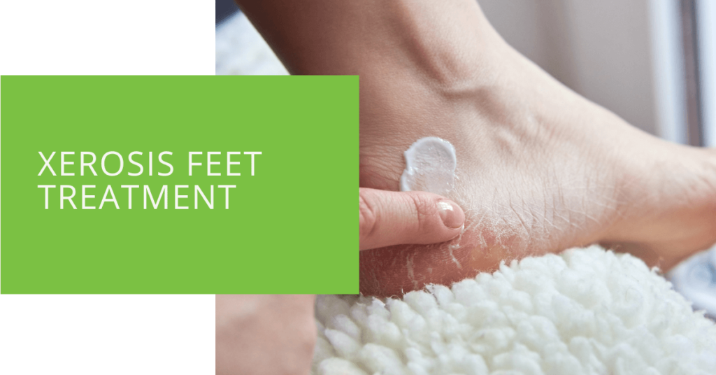 Xerosis Feet Treatment