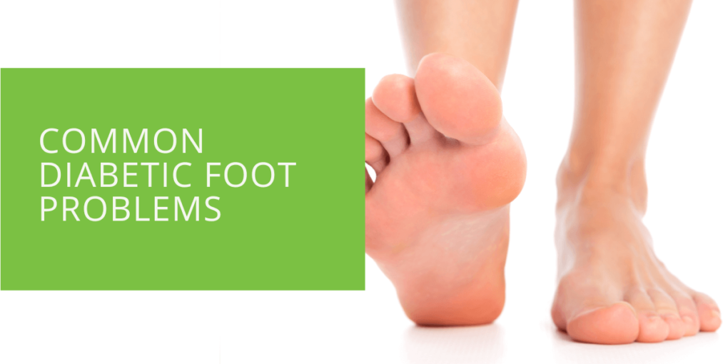 Common Diabetic Foot Problems