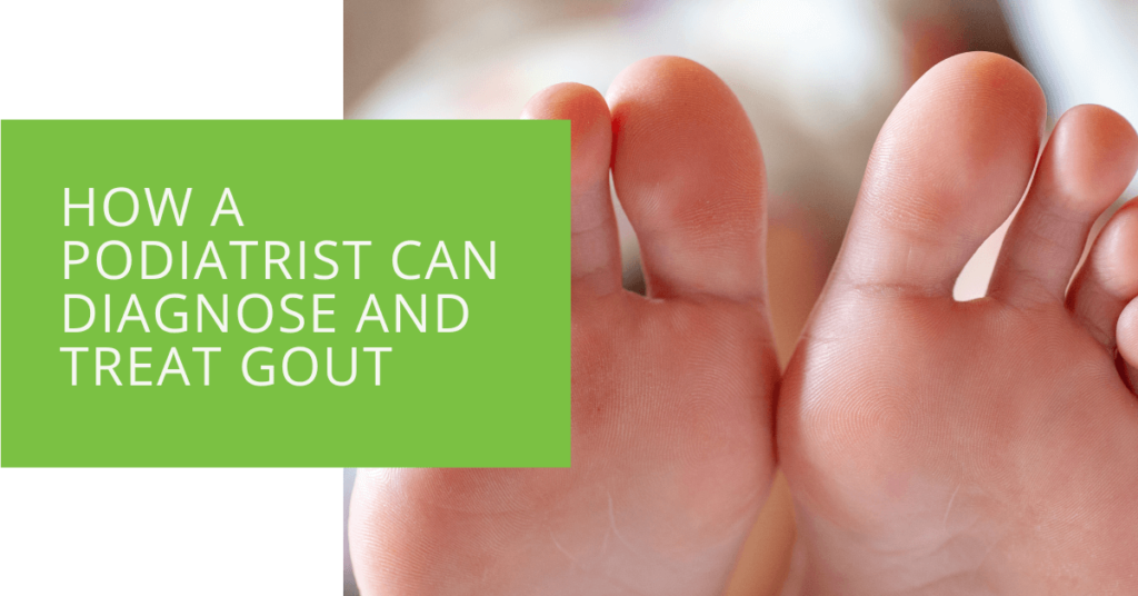 How A Podiatrist Can Diagnose and Treat Gout
