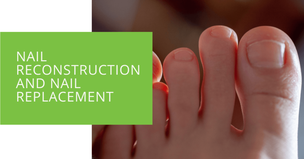 Nail Reconstruction and Nail Replacement